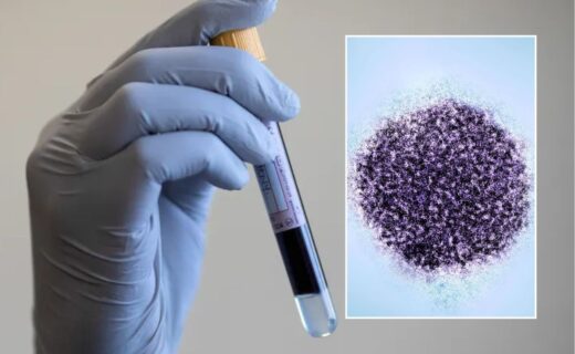 England close to wiping out Hepatitis C 'for good' in boost for global eradication