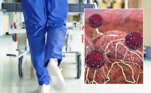Scientists sound alarm as lethal fungal infection tearing through hospitals kills a third of patients