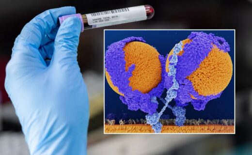 'Very exciting': Breakthrough therapy could cut bad cholesterol by up to 62% — with effects lasting a year