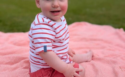 'Cheeky' one-year-old baby boy with rare skull condition successfully undergoes world-first surgery