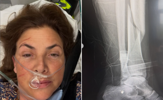 Kirstie Allsopp rushed to hospital by air ambulance and undergoes surgery after horror birthday fall